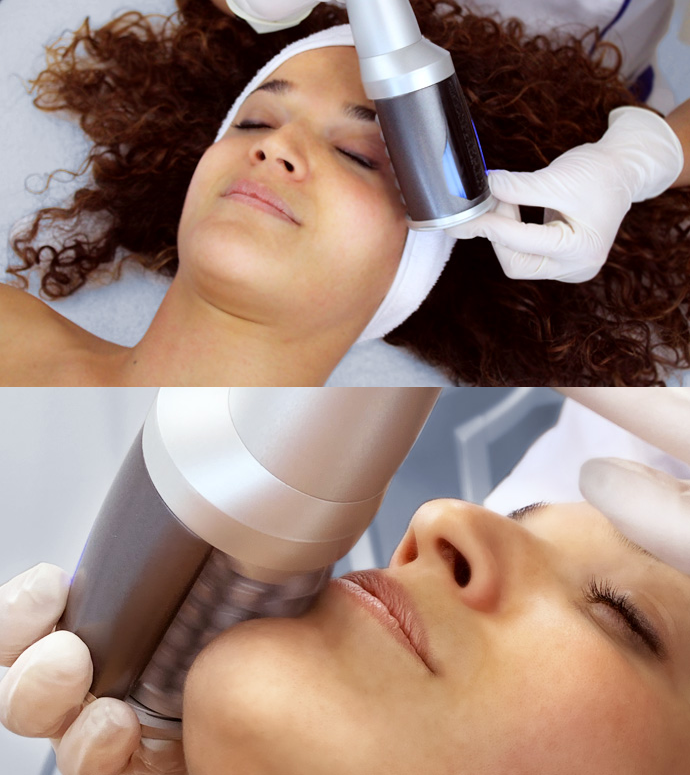 Portable Vacuum Roller Therapy Weight Loss Machine