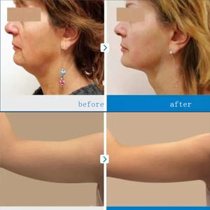 Vertical 7D HIFU Facial Lifting Device With 7 Cartridges