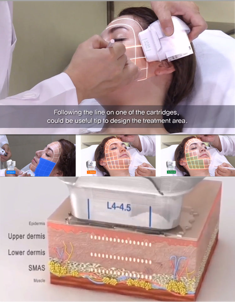 Double handle 7D HIFU Facial Lifting Device With 7 Cartridges