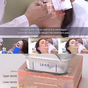 7D hifu machine face lifting wrinkle removal body slimming device hifu 7d with 7 cartridges