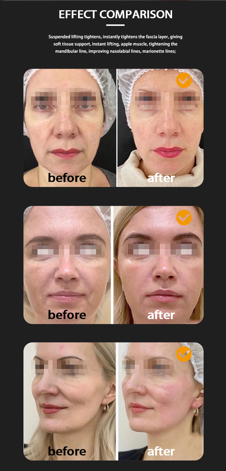 7D hifu machine face lifting wrinkle removal body slimming device hifu 7d with 7 cartridges