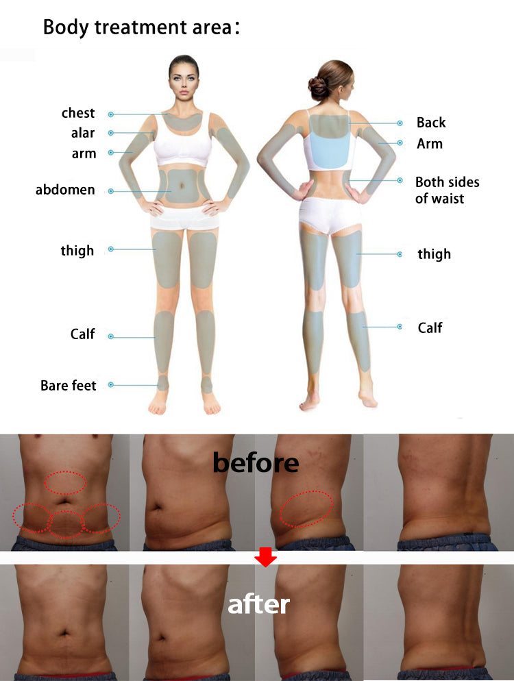 7D hifu machine face lifting wrinkle removal body slimming device hifu 7d with 7 cartridges