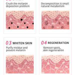 Non-invasive Strong Picosecond Tattoo Removal for Tattoo Removal Pigmentation and Carbon Peeling Rejuvenation skin whitening