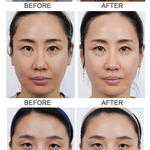 Latest  HIFU Ultra Booster pen circular 3 handles Anti-aging Machine