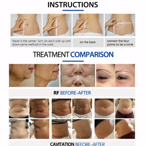 40K Ultrasound Cavitation Machine Weight Loss BodySlimming Machine