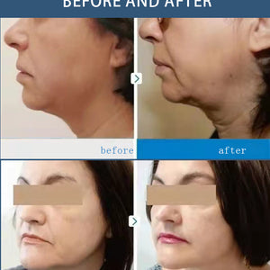 Vertical 7D HIFU Facial Lifting Device With 7 Cartridges