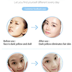 Oxygene Jet Peel Hydrodermabrasion Facial Machine Skincare Oxygenated Facial Machine