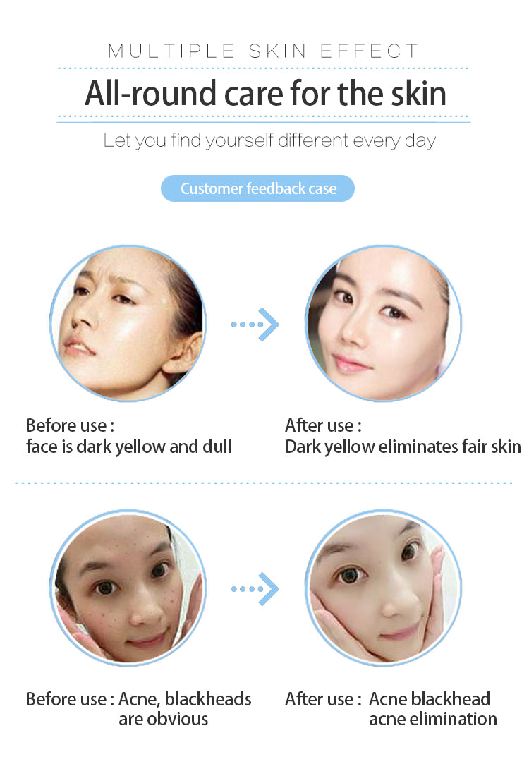 Oxygene Jet Peel Hydrodermabrasion Facial Machine Skincare Oxygenated Facial Machine