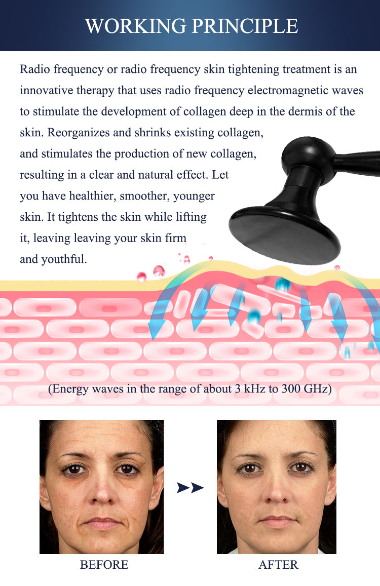 Skin Care Device Face Lifting Wrinkle Removal Eye Care RF Skin Tightening Machine