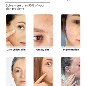 6 In 1 Oxygen Small Bubble Aqua Facial Peel H2O2 RF Face Lifting Skin Tightening Machine