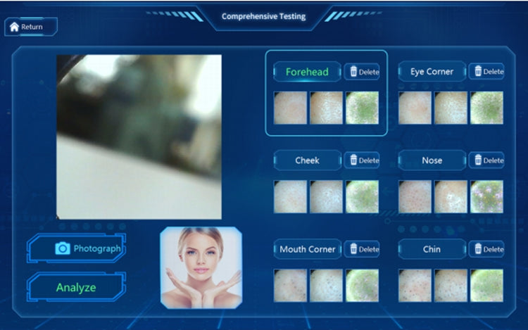 7 in 1 water peel microdermabrasion hydrodermabrasion facial machine with skin analyzer