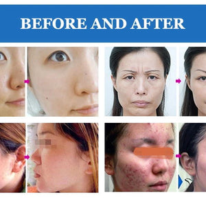 Facial Electric 7 color LED light PDT Therapy Skin Care Beauty Machine for Face and Body