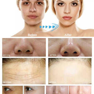 Hydro Beauty Facial Machines for face deep clean facial skin care equipment