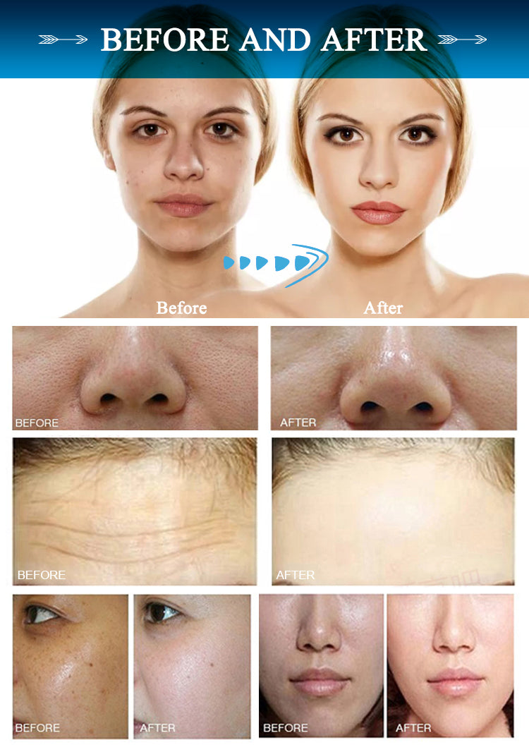 Hydro Beauty Facial Machines for face deep clean facial skin care equipment