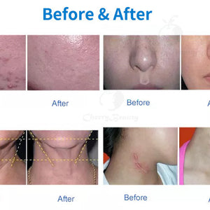 New 6 In 1 Facial Skin Whitening Rejuvenation Tightening Care 7 Colors Pdt Led Photon Light Therapy Machine for sale