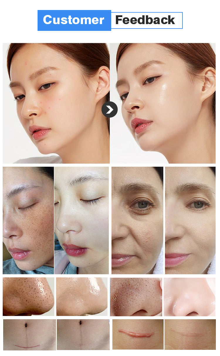 14 In 1 Korea Aqua Peeling Machine Hydro Oxyge Facial Diamond Dermabrasion Machine