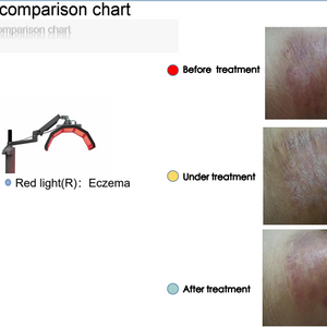 Vertical Led Light Therapy Professional Beauty Equipment PDT Led Light Therapy
