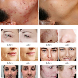 12 In 1 Alice Bubble Peptide Facial Peeling Hydro Skin Care Beauty Machine