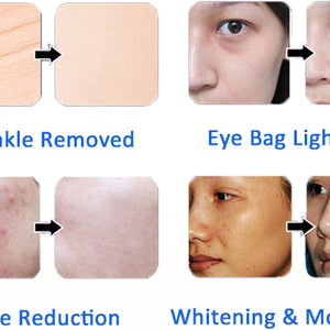 7 in 1 hydro facials Machine Small Bubbles with Mask