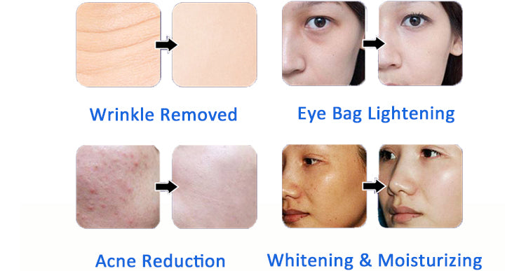 7 in 1 hydro facials Machine Small Bubbles with Mask