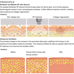 7 in 1 40K Cavitation Slimming Reduce Fat Body Lifting Machine