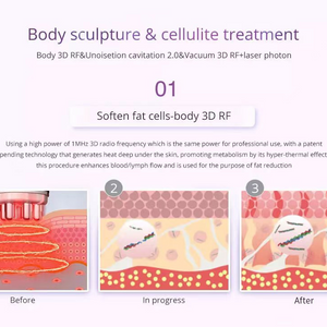 9 IN 1 Lipolaser Rf Ultrasonic 40K Vacuum Cavitation System Slimming Beauty Machine