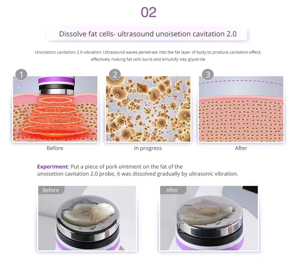 9 IN 1 Lipolaser Rf Ultrasonic 40K Vacuum Cavitation System Slimming Beauty Machine