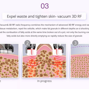 9 IN 1 Lipolaser Rf Ultrasonic 40K Vacuum Cavitation System Slimming Beauty Machine