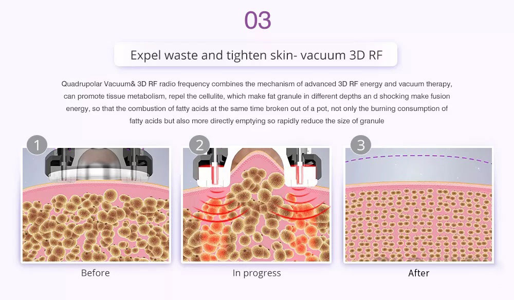 9 IN 1 Lipolaser Rf Ultrasonic 40K Vacuum Cavitation System Slimming Beauty Machine