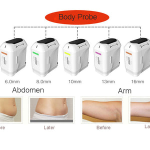 2 in 1 6D HIFU Body Face Lifting And Liposonic Device