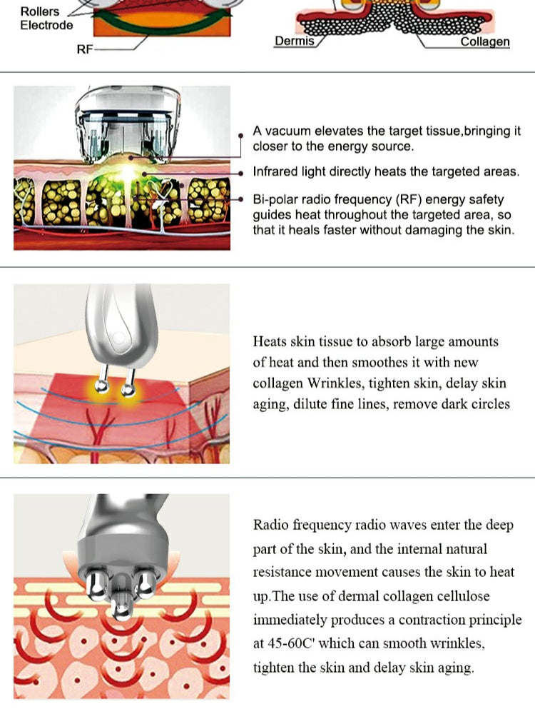 Velashape X9 anti-cellulite RF Vacuum Roller Fat Removal Machine