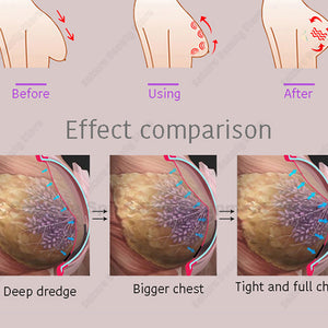 New Butt Lifting And Enlargement Vacuum Therapy Machine