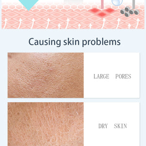 Spa660 Ultrasonic Hydrating Facial Microdermabrasion Machine Skin Care Machine