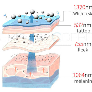 Vertical Picosecond Laser Tattoo Removal Pigmentation Therapy Device