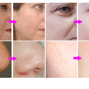 Spa660 Ultrasonic Hydrating Facial Microdermabrasion Machine Skin Care Machine