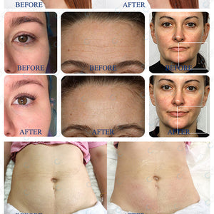 Professional Alien RF 80k /40k Ultrasound Cavitation Body Slimming Machine