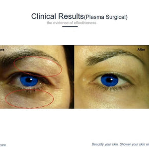 Plasma skin rejuvenation medical facial lifting beauty machine