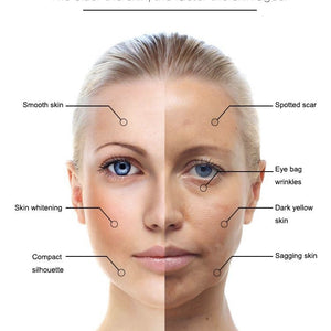 Hifu 2D Anti-wrinkle  skin Tightening Face Lifting  Device