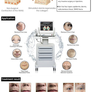 Hifu 2D Anti-wrinkle  skin Tightening Face Lifting  Device