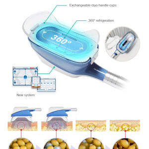 Portable 360 degree cryolipolysis fat freezing body slimming machine