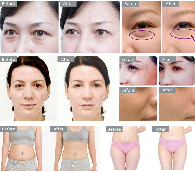 8 in 1 40k Ultrasound Cavitation Body Sculpting machine