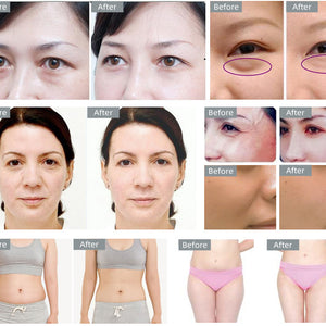 5D Cavitation Vacuum Body Slimming Machine