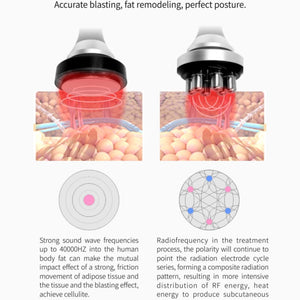 Professional Vertical Cryolipolysis Machine with 4  handles