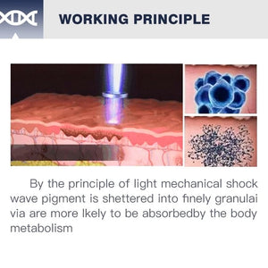 Portable picosecond laser tattoo pigment removal