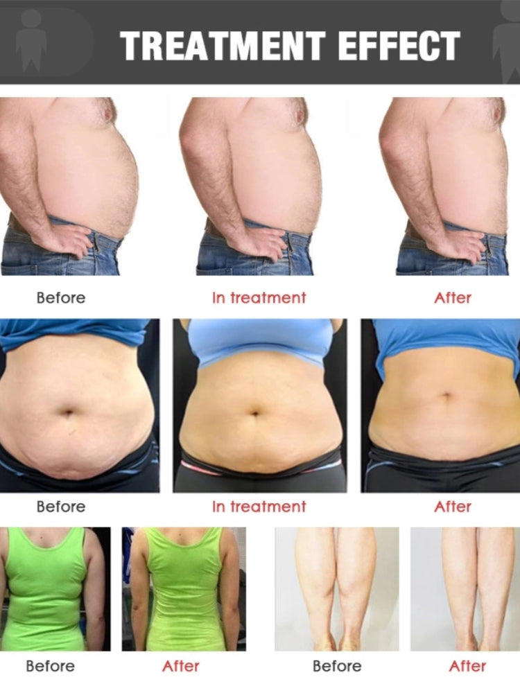 Velashape X9 anti-cellulite RF Vacuum Roller Fat Removal Machine