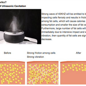 Portable six-in-one cavitation machine with lipo laser pads