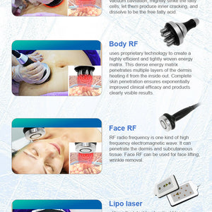 Portable 360 degree cryolipolysis weight loss fat freezing body slimming machine