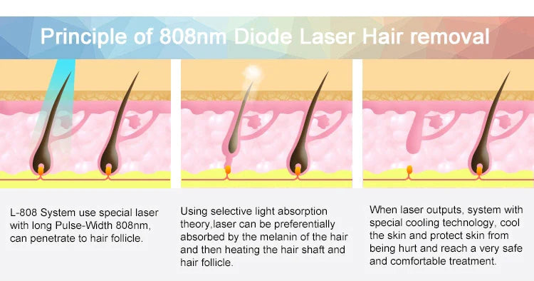 2 in 1 diode laser hair removal machine picosecond pigments removal machine