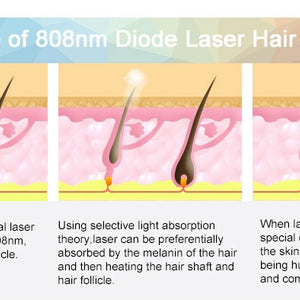 Professional painless 1600w diode laser hair removal Machine