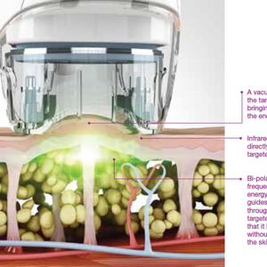 V8L 4 In 1 Body Contouring Effective Weight Loss Beauty Equipment